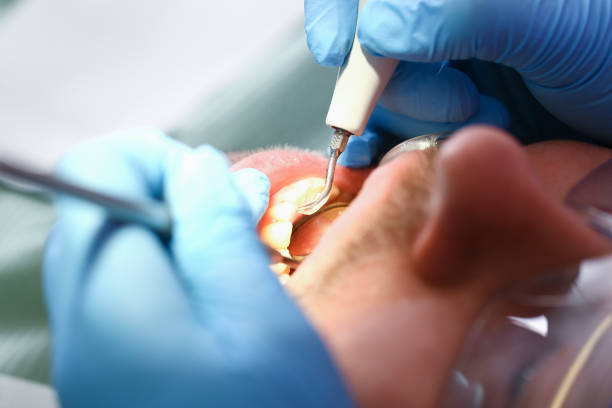 Best Emergency Root Canal Treatment in Holiday Island, AR