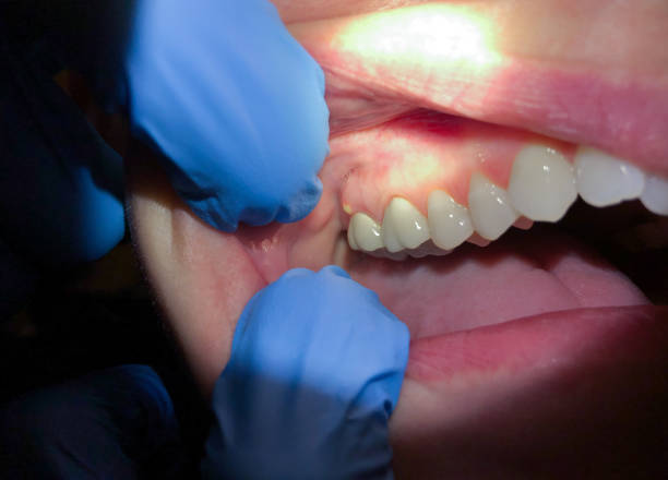 Best Emergency Tooth Extraction in Holiday Island, AR
